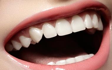 牙齒發黃是什麼原因 要如何護理