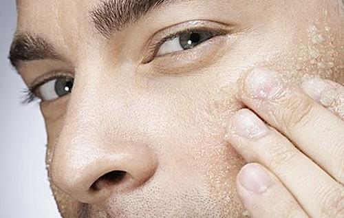 男人消除黑眼圈的六個小方法